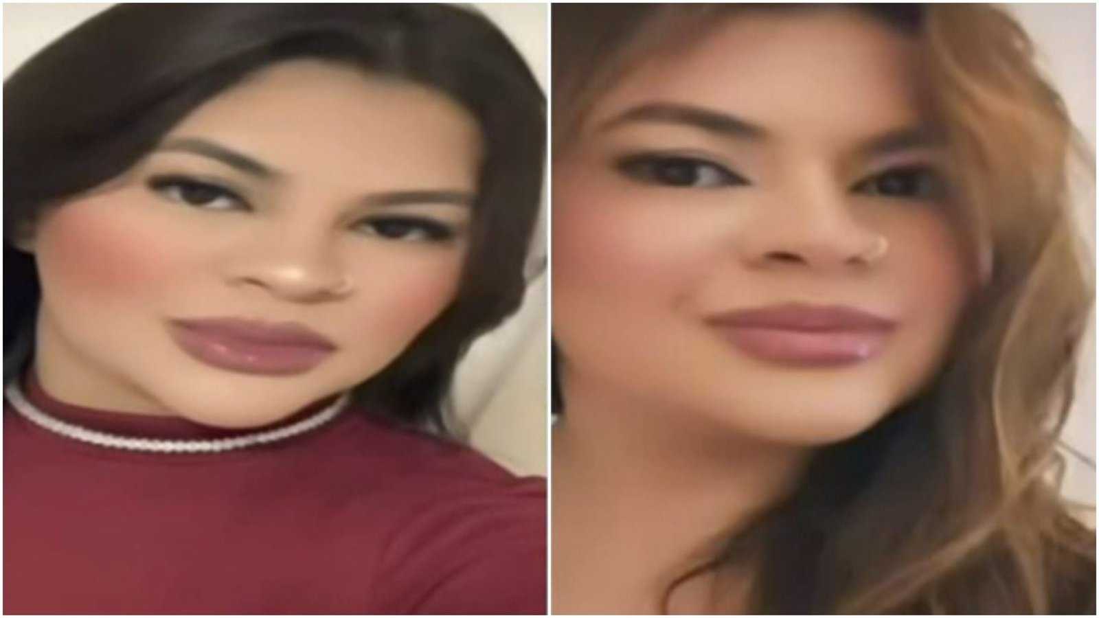 tante de tudo é que o doutor mandou ela mexer com o dedo e ela já começou a mexe
