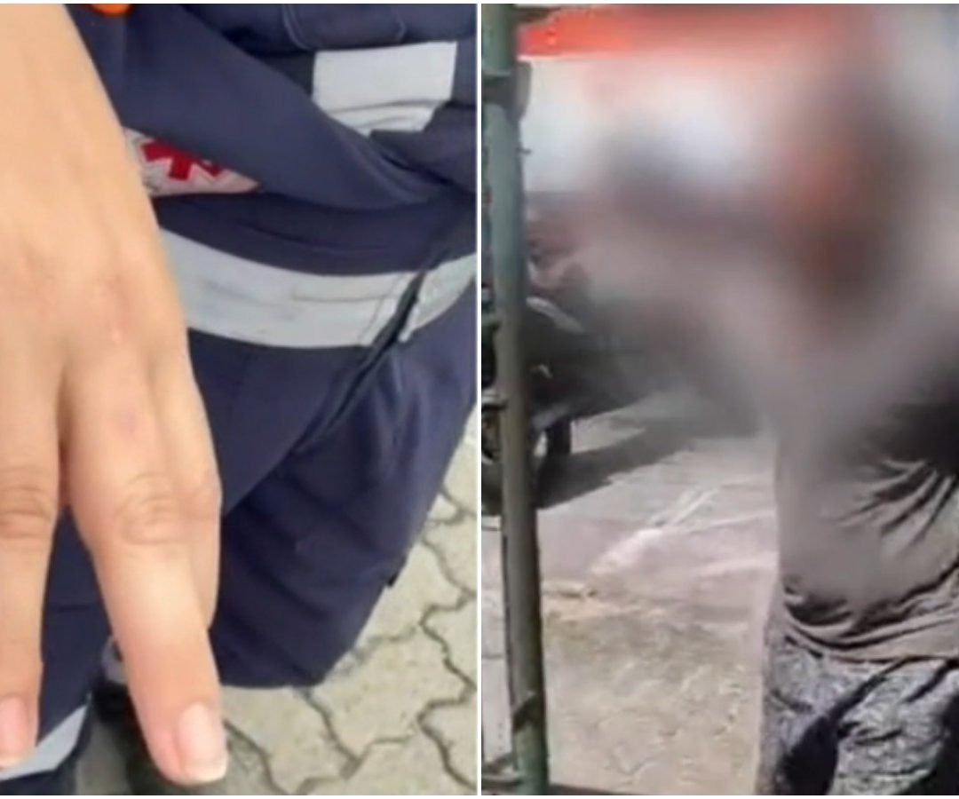 Marcas de agressão Técnica de enfermagem do Samu é agredida durante atendimento em Fortaleza TV Verdes Mares/Reprodução
