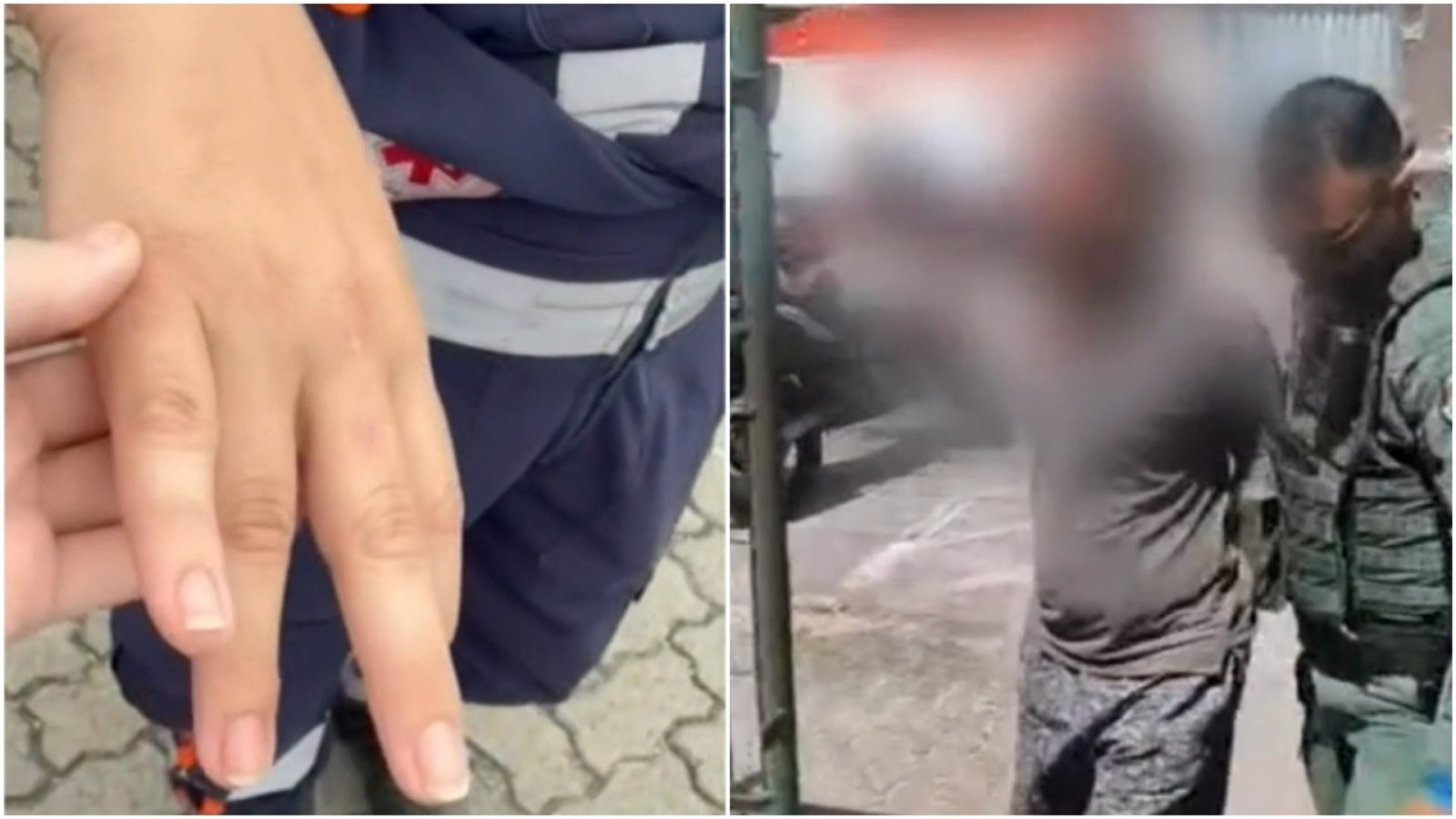 Marcas de agressão Técnica de enfermagem do Samu é agredida durante atendimento em Fortaleza TV Verdes Mares/Reprodução