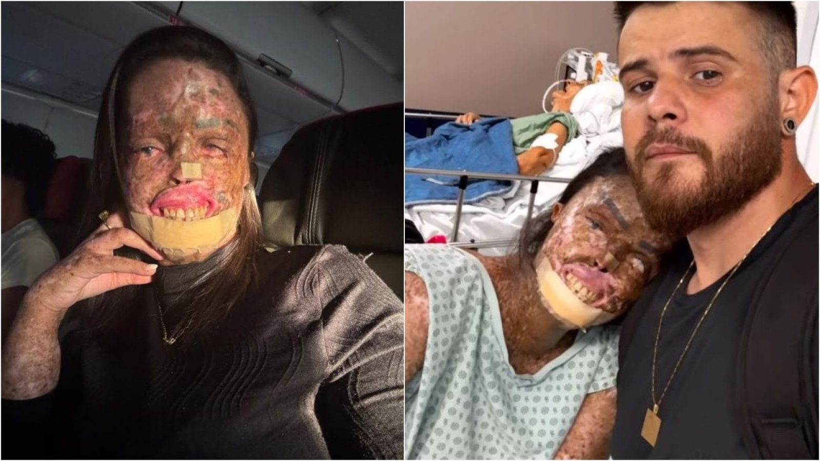 Influencer Karine de Sousa morre após batalha contra xeroderma pigmentoso