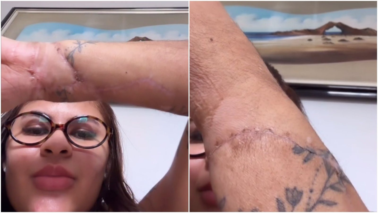 “Marcas do meu milagre”: Ana Clara exibe cicatrizes das mãos reimplantadas após ataque do ex